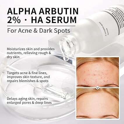 Alpha Arbutin Face Serum